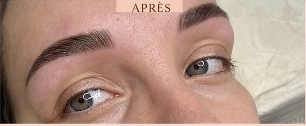 Après BROWLIFT