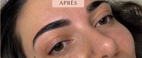 Après BROWLIFT