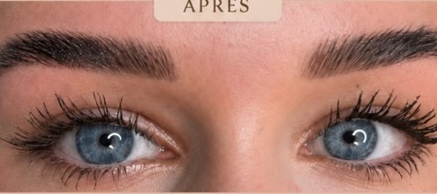 Après BROWLIFT, cliente aux yeux bleus