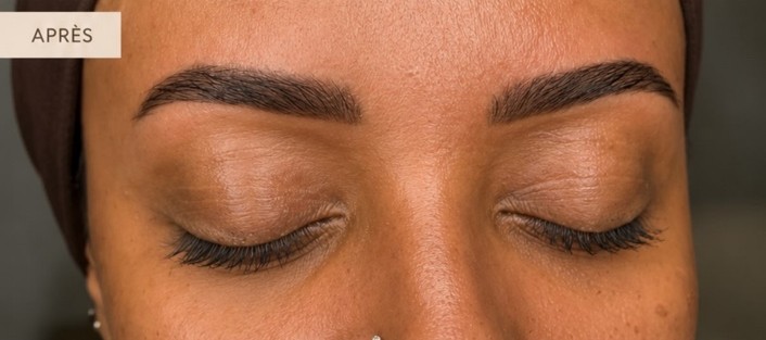 Après restructuration des sourcils
