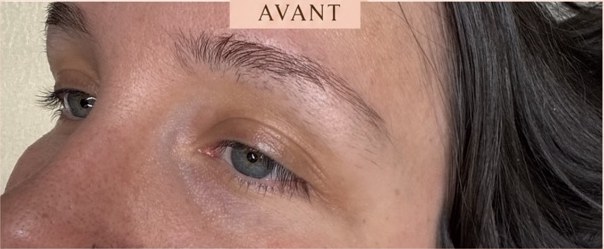 Avant BROWLIFT