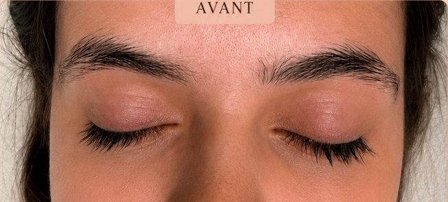 Avant restructuration